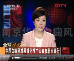 CCTV4报道：GX-B多维白癜风康复工程成果转化推广大会在北京举行